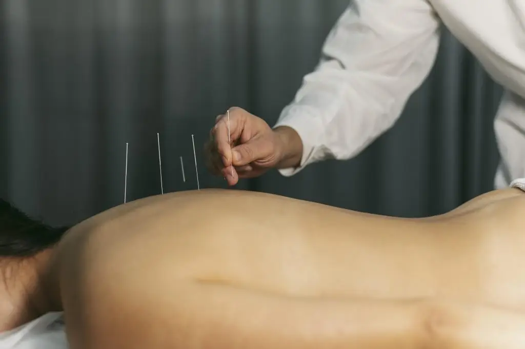 Acupuncturist in Den helder